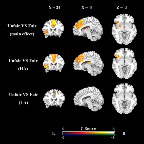 attractive female faces activates the brain's reward circuits in males