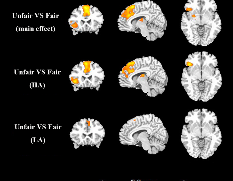 attractive female faces activates the brain's reward circuits in males