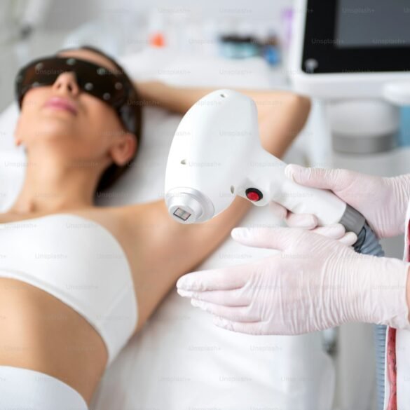 Laser Hair Removal